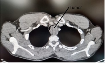 Cancer/Radiothérapie, Journal